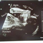 Bild zu Organscreening - Forum für Juni - Mamis