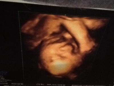 Bild zu Freude :) - Forum für Juni - Mamis