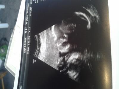 Bild zu heute fa mit Bild - Forum für Juni - Mamis