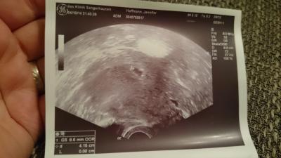 Bild zu 1. Bildchen - Forum für Juni - Mamis