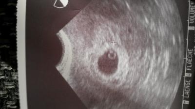 Bild zu FA Termin ist gut gelaufen! - Forum für Juni - Mamis