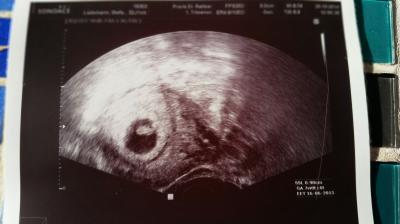 Bild zu ***Zurück vom Frauenarzt*** - Forum für Juni - Mamis