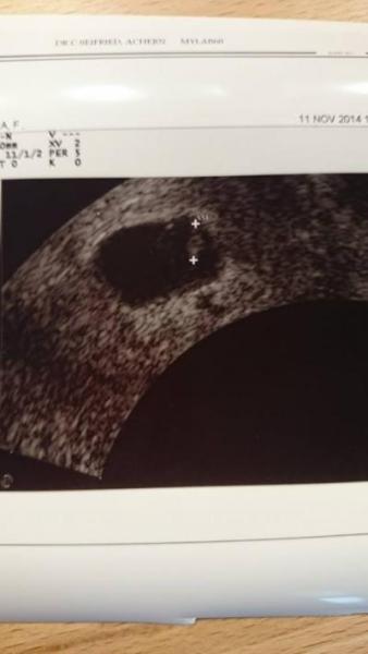 Bild zu Zurück vom FA :) - Forum für Juni - Mamis