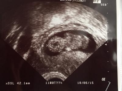 Bild zu Auch mal wieder melden - Forum für Juni - Mamis