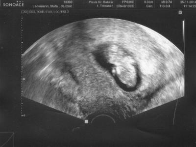 Bild zu ***Zurück von zweiter Vorsorgeuntersuchung*** - Forum für Juni - Mamis