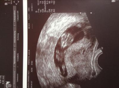 Bild zu Zurück vom Baby TV - Forum für Juni - Mamis