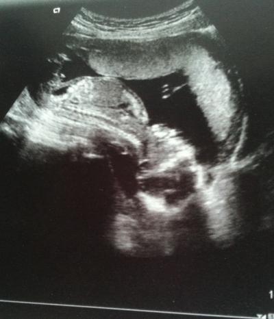 Bild zu FA Termin - Forum für Juni - Mamis