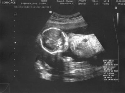 Bild zu *** Zurück vom Baby-TV. Leider ohne Outing. :-( *** - Forum für Juni - Mamis