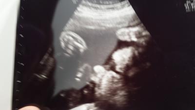 Bild zu 3. US und Biiiild - Forum für Juni - Mamis