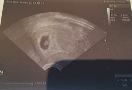 Bild zu Ultraschall bei 7+1 - Forum für Juni - Mamis