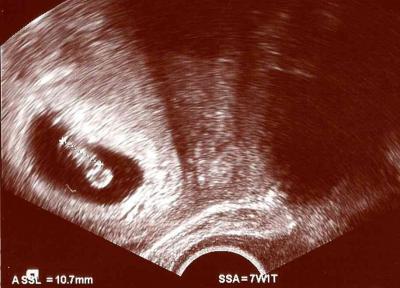 Bild zu Fototermin ;-) - Forum für Juni - Mamis