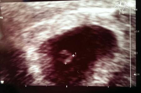 Bild zu 5+6 und das erste Bild :-) - Forum für Juni - Mamis