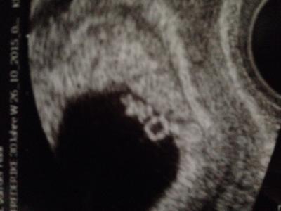 Bild zu Hallo, das bin ich! - Forum für Juni - Mamis