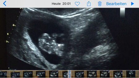 Bild zu 