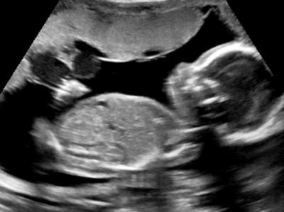Bild zu Zurück vom 2. US - Forum für Juni - Mamis