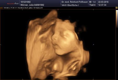 Bild zu Vu und 3. Großer Ultraschall - Forum für Juni - Mamis