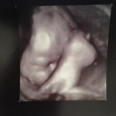 Bild zu Gestern Geburtsplanung und Ultraschallkontrolle - Forum für Juni - Mamis