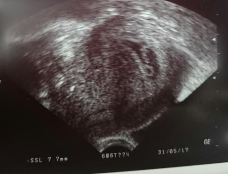 Bild zu Erstes US Bild... - Forum für Juni - Mamis
