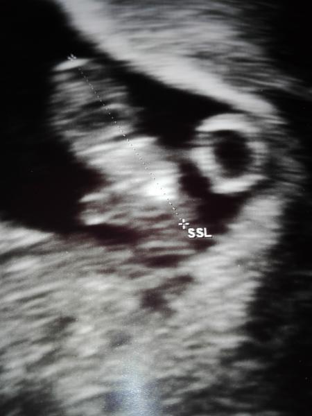 Bild zu Zurück vom FA. Glücklich < 3 - Forum für Juni - Mamis