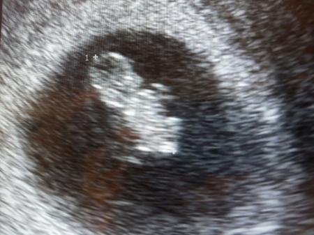 Bild zu auch ich bin zurück! - Forum für Juni - Mamis