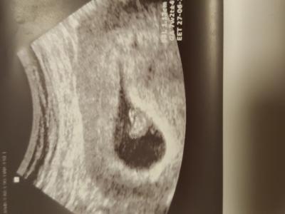 Bild zu Zurück vom Arzt - Forum für Juni - Mamis