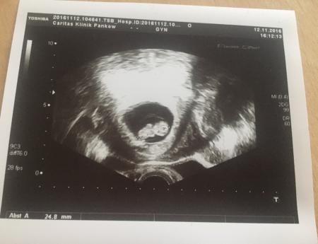 Bild zu Wieder im KH/ wissen nun endlich die genaue SSW - Forum für Juni - Mamis