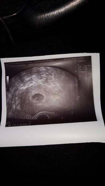 Bild zu Erster FA Termin - Forum für Juni - Mamis