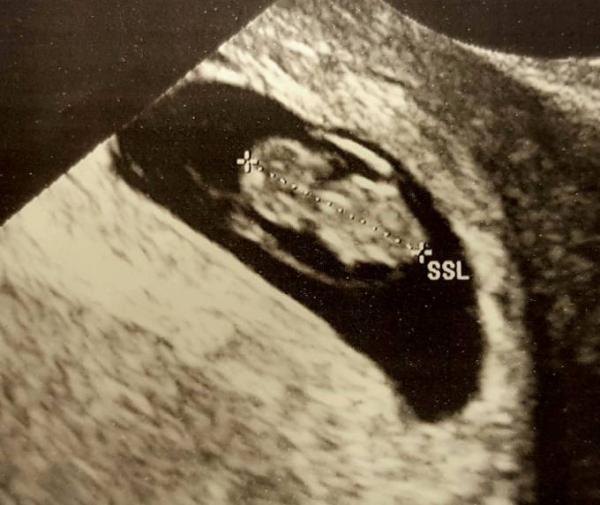 Bild zu Ich Geselle mich mal zu euch. - Forum für Juni - Mamis