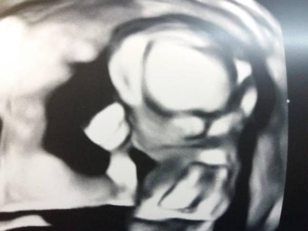 Bild zu Hier auch- 3d- Ultraschall - Forum für Juni - Mamis