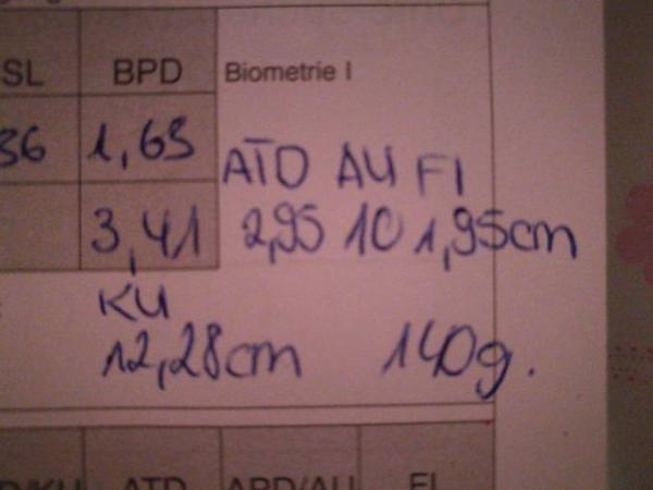 Bild zu 