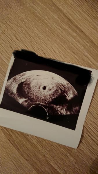 Bild zu Mein erster FA Termin - Forum für Juni - Mamis
