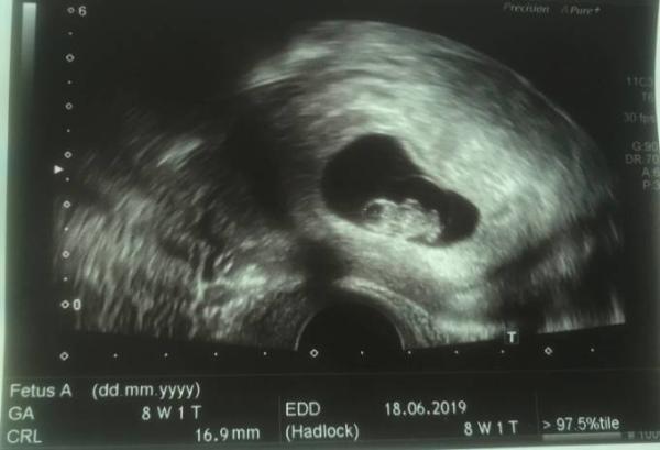 Bild zu Verliebt :-))) - Forum für Juni - Mamis