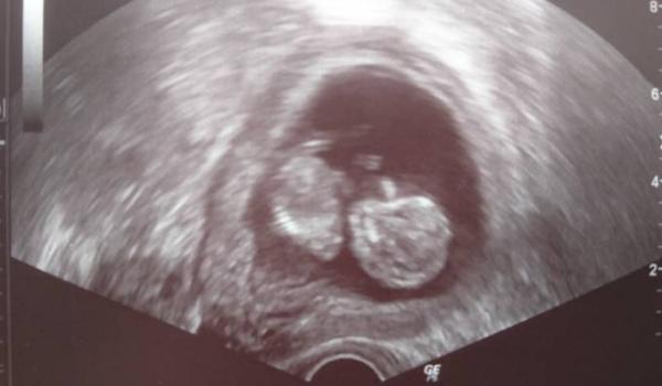 Bild zu Zurück vom FA - Forum für Juni - Mamis