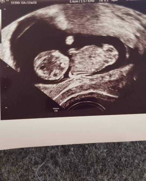 Bild zu Zurück von FA Termin - Forum für Juni - Mamis
