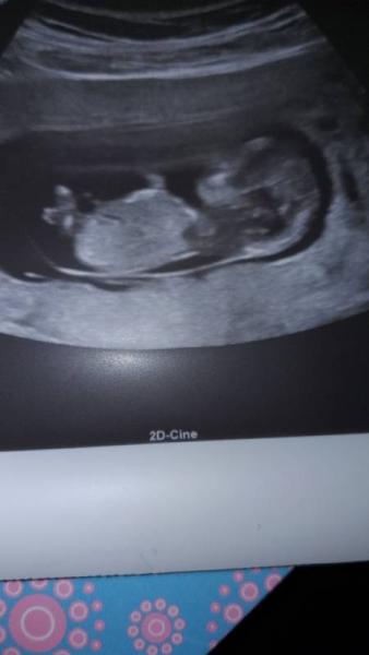 Bild zu Ich bin verliebt 😍❤❤❤ - Forum für Juni - Mamis