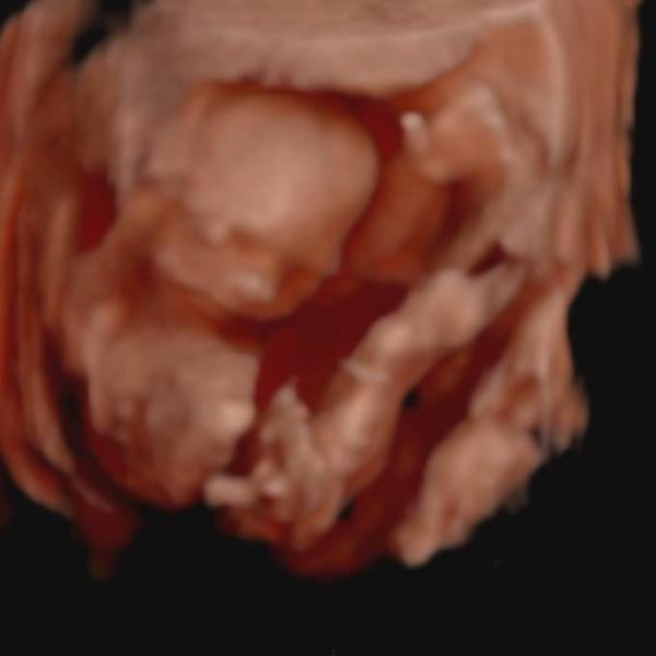 Bild zu Wollt mal Hallo sagen - Forum für Juni - Mamis
