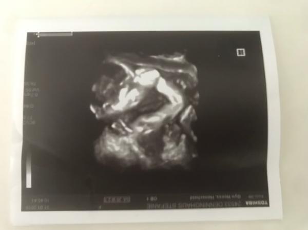 Bild zu Heute zweite große Ultraschall Untersuchung - Forum für Juni - Mamis
