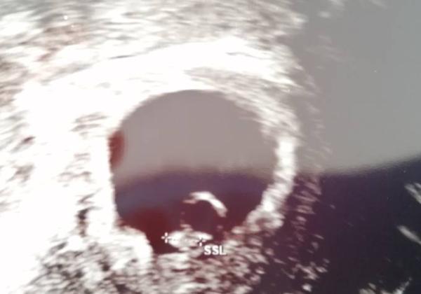Bild zu Erster Termin beim Frauenarzt - Forum für Juni - Mamis