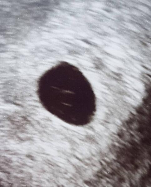 Bild zu Kann mich noch immer nicht freuen....2. US - Forum für Juni - Mamis