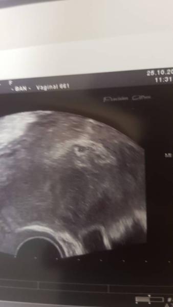 Bild zu Eine letzte Meldung - Forum für Juni - Mamis