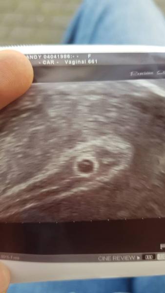 Bild zu Ich bin ein medizinisches Wunder - Forum für Juni - Mamis