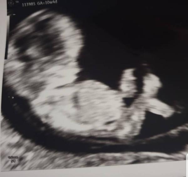 Bild zu Us Termin - Forum für Juni - Mamis