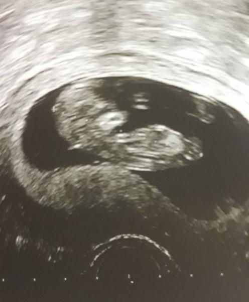 Bild zu Update - Forum für Juni - Mamis