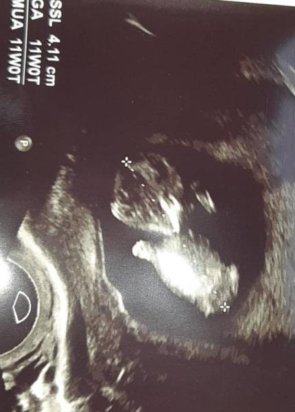 Bild zu Aus einer kleinen Erdnuss, wird ein Baby - Forum für Juni - Mamis