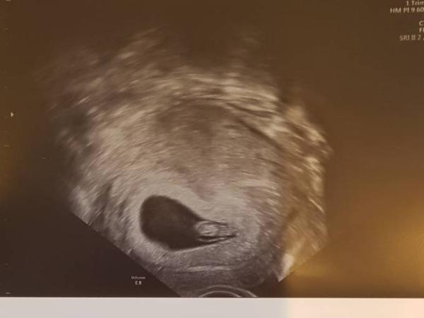 Bild zu Endlich der erste FA Termin - Forum für Juni - Mamis