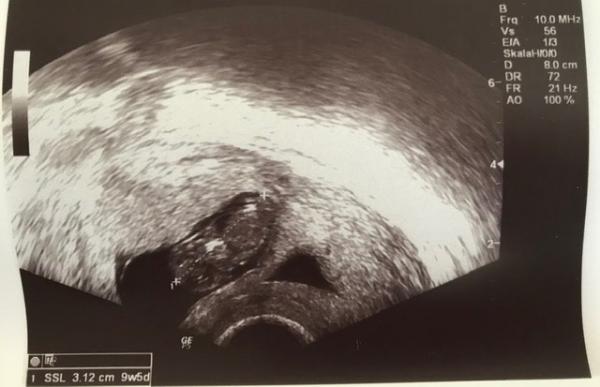 Bild zu Winkende Babys - Forum für Juni - Mamis