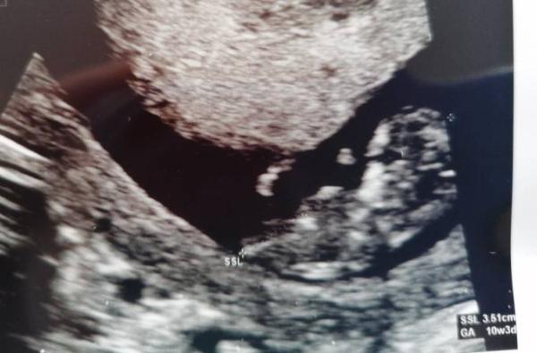 Bild zu Baby b. ♥️ - Forum für Juni - Mamis
