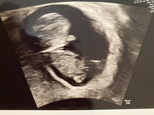 Bild zu Seht ihr das auch? - Forum für Juni - Mamis