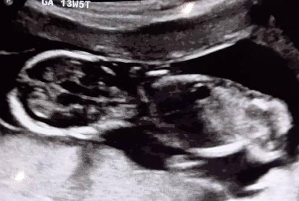 Bild zu Ein so schöner Arztbesuch - Forum für Juni - Mamis