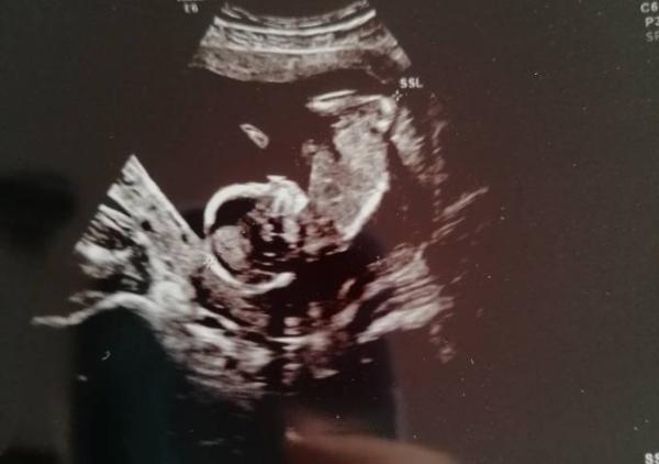 Bild zu 9 cm lebendes Glück - Forum für Juni - Mamis